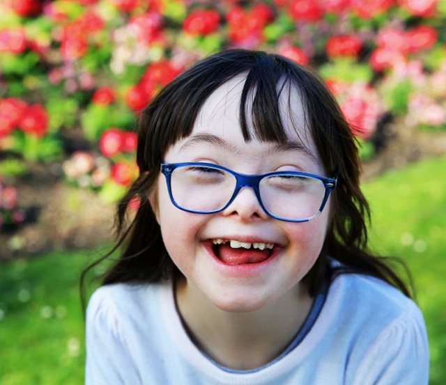 a special needs patient smiling during a dental visit