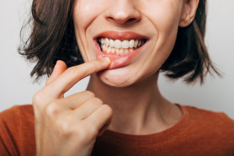 Lady shows gum tissue